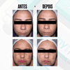 CREAMY Glicointense Peel - Clinical Night Peel with Glycolic Acid - 30g-Creamy Skincare