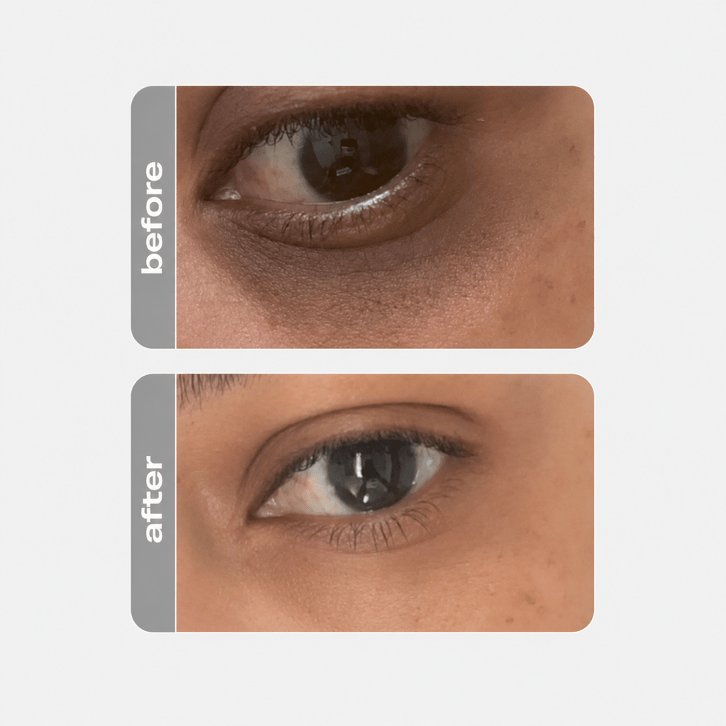 CREAMY Eye Cream - Brightening Anti-Wrinkle - Creamy Skincare