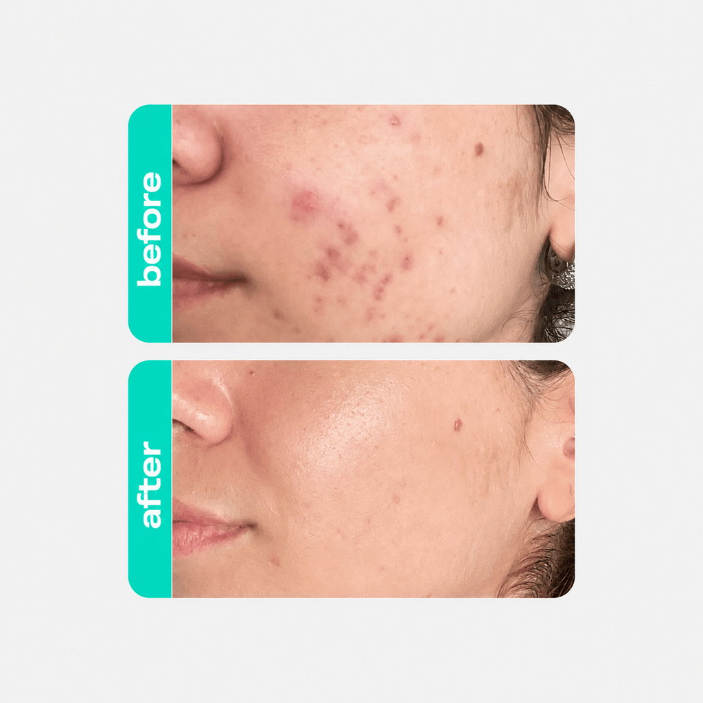 CREAMY Glicointense Peel - Clinical Night Peel with Glycolic Acid - 30g - Creamy Skincare