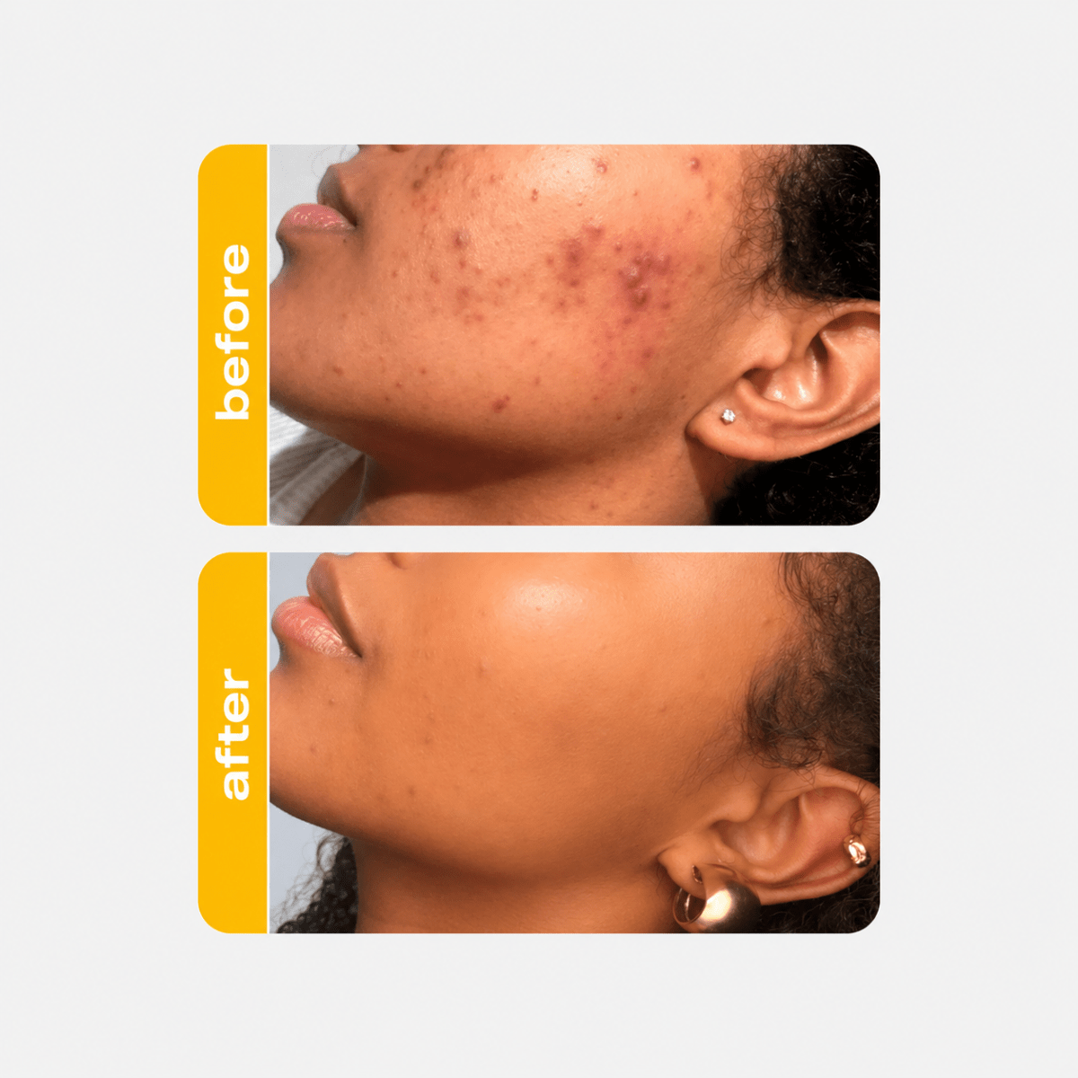 CREAMY Hydrating 5% Lactic Serum - Creamy Skincare