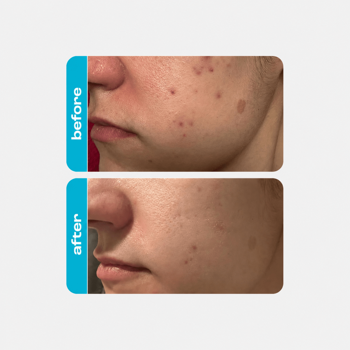 CREAMY Regenerating 10% Glycolic Moisturizer - Creamy Skincare