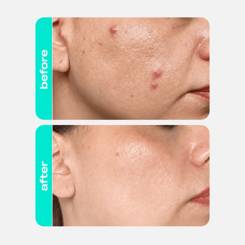 CREAMY Salicylic Acid Toner - Creamy Skincare